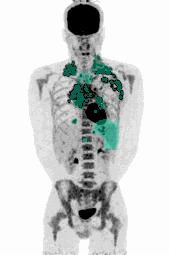 AI segmentation algorithms